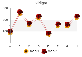 purchase sildigra 25mg line