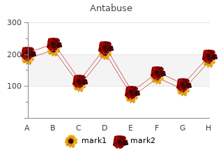 generic antabuse 250mg free shipping