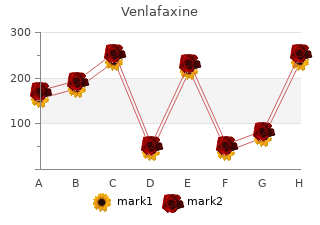 purchase venlafaxine 150mg free shipping