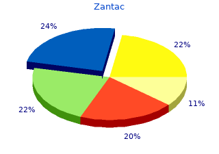 zantac 300mg amex