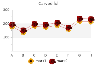 buy generic carvedilol 6.25mg on-line