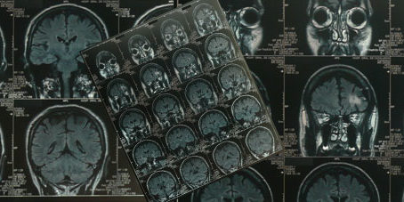 featureslider_craneo