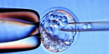 featureslider_celulas