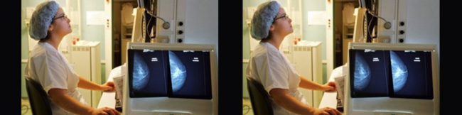 featureslider_cancermama