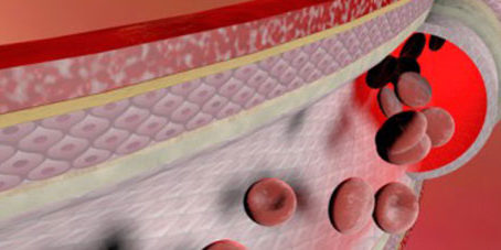 featureslider_vasossanguineos