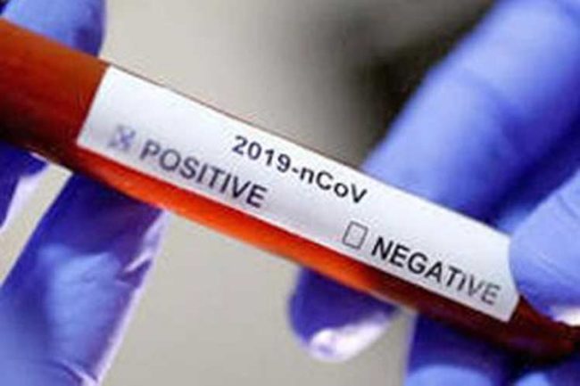 Coronavirus4