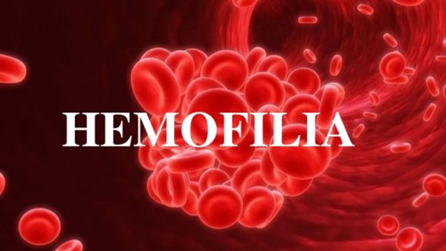 Hemofilia