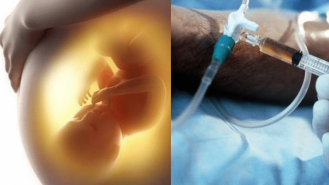 Aborto
